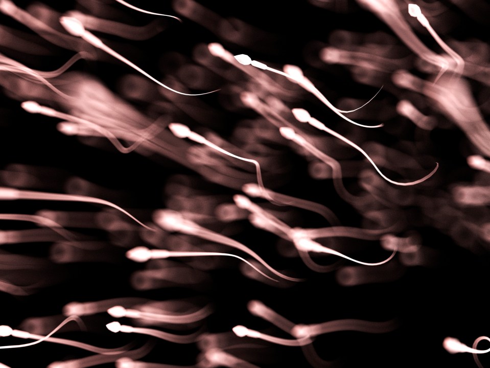 Illustration of multiple sperm cells moving against a black background.