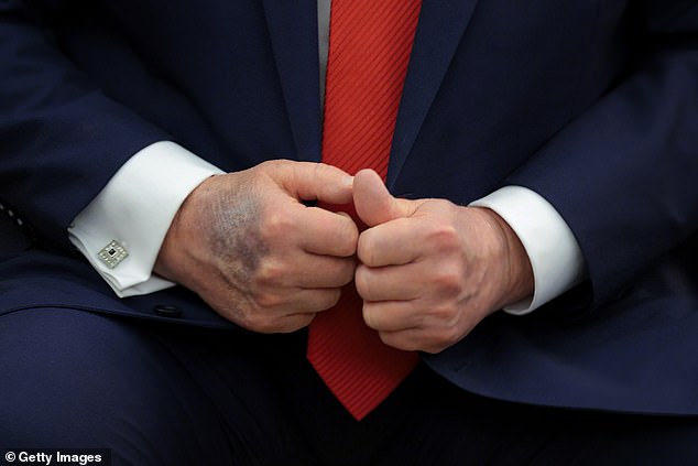 Trump's hands are seen as he met South Korean president Lee Jae Myung in August