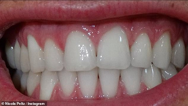 Dr Mervyn Druian of The London Centre for Cosmetic Dentristy agreeing there has been a change in her teeth since this photo of them taken in 2020