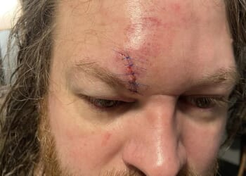 A father has been left needing stitches in his face after a brutal fight broke out in line for a the Indiana Jones Adventure ride at Disneyland last Tuesday, as shown above