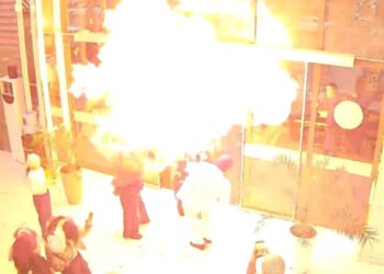 Horror moment party balloons explode in giant FIREBALL burning birthday girl’s face as family surprise goes badly wrong