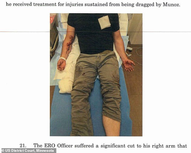 The officer needed 20 stitches in his right arm after being dragged 100 yards in June