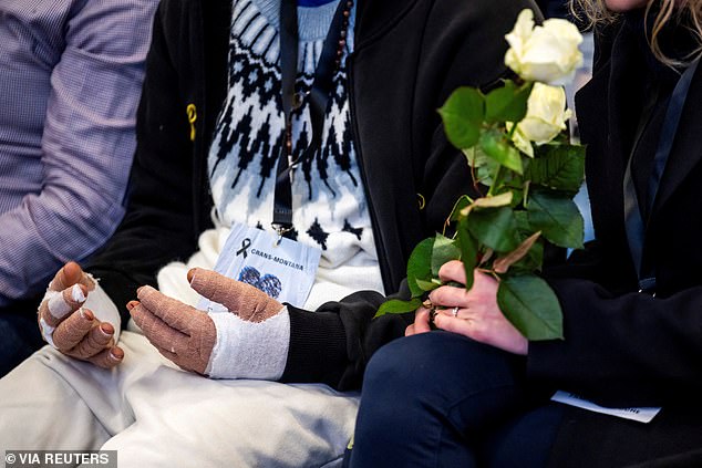A victim with burned hands attends the official commemorative ceremony and the national day of mourning in Martigny, Switzerland, Friday, January 9, 2026