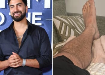 Love Island star Lochan Nowacki in A&E dash after suffering horror foot injury