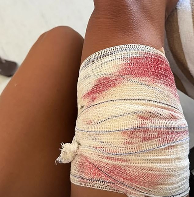 The dive took place in front of a fishermen's association, where tourists frequently gather to see sharks