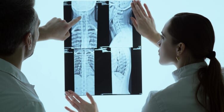 Is your back pain a spinal FRACTURE? Staggering 2.2million Brits 'living with hidden, agonising' breaks