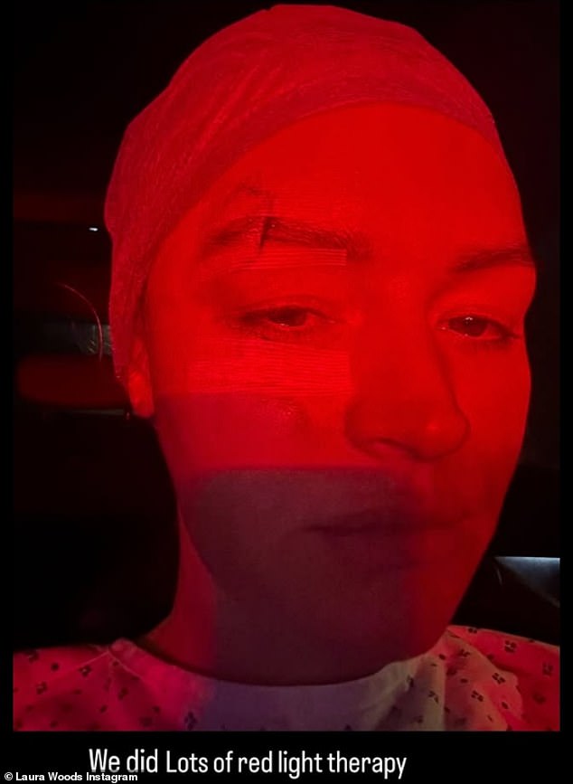 The presenter also underwent 'lots of red light therapy' in the aftermath of the accident