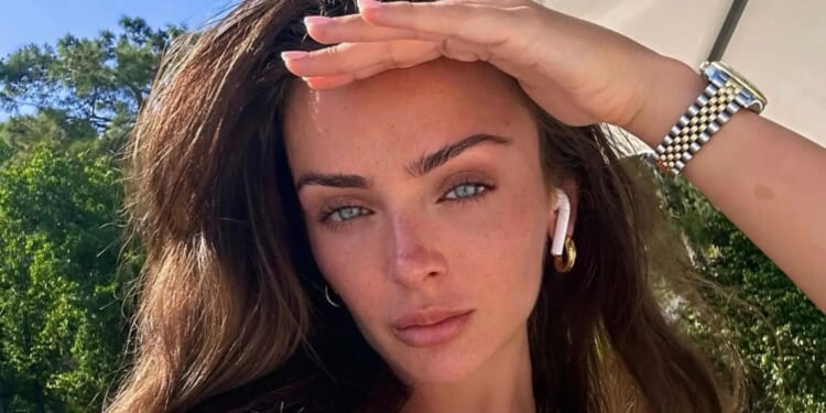 Love Island beauty Kady McDermott reveals 'secret nose job' as she shares snaps after getting cast removed