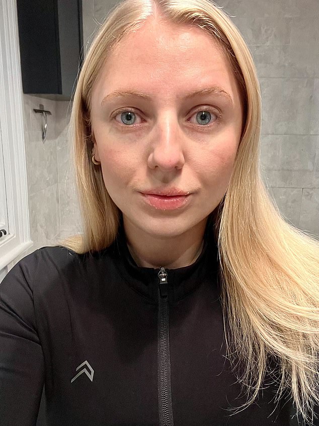 Hannah three days into treating a flare-up - brought on by switching between windy streets, hot coffee shops, freezing Tube plaforms and stuffy offices