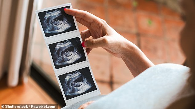 Around 118 boys have been born to Indian mothers for every 100 girls between 2021 and 2025, a (Stock image)