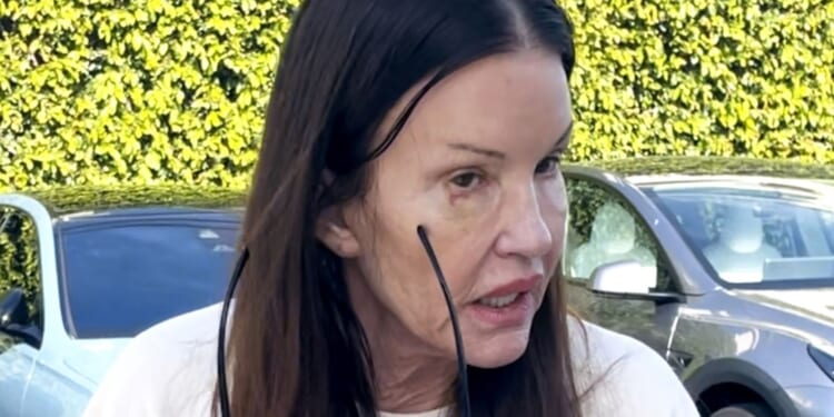 Janice Dickinson shows off injuries from horrific I'm A Celeb fall ahead of ITV court showdown