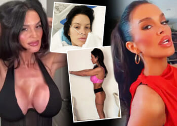 Mum left with gaping hole 'gushing fluid' from her bum and on death's door after 'safe' 6K BBL gone wrong