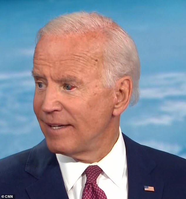 Biden was in the middle of speaking when his eye appeared to fill with blood, but he seemed not to notice.