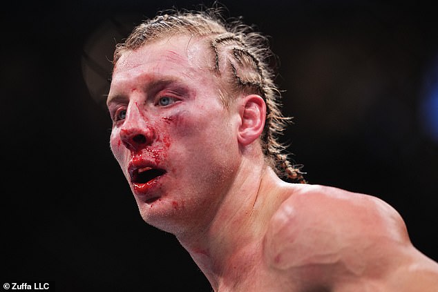 Pimblett was left bruised and bloodied and was rushed to hospital after the fight concluded