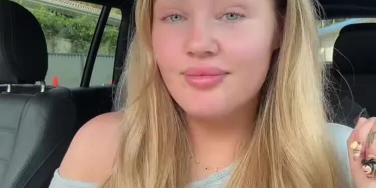 I got my lip filler dissolved