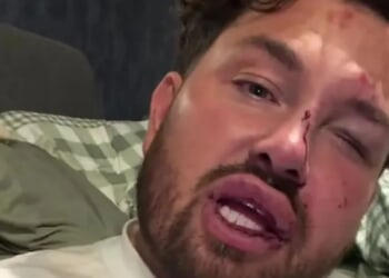 Married at First Sight star breaks down after being attacked as he reveals black eye, cuts and bruises