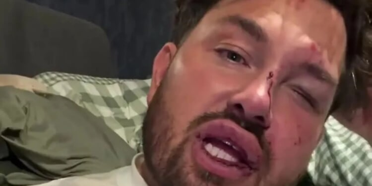 Married at First Sight star breaks down after being attacked as he reveals black eye, cuts and bruises