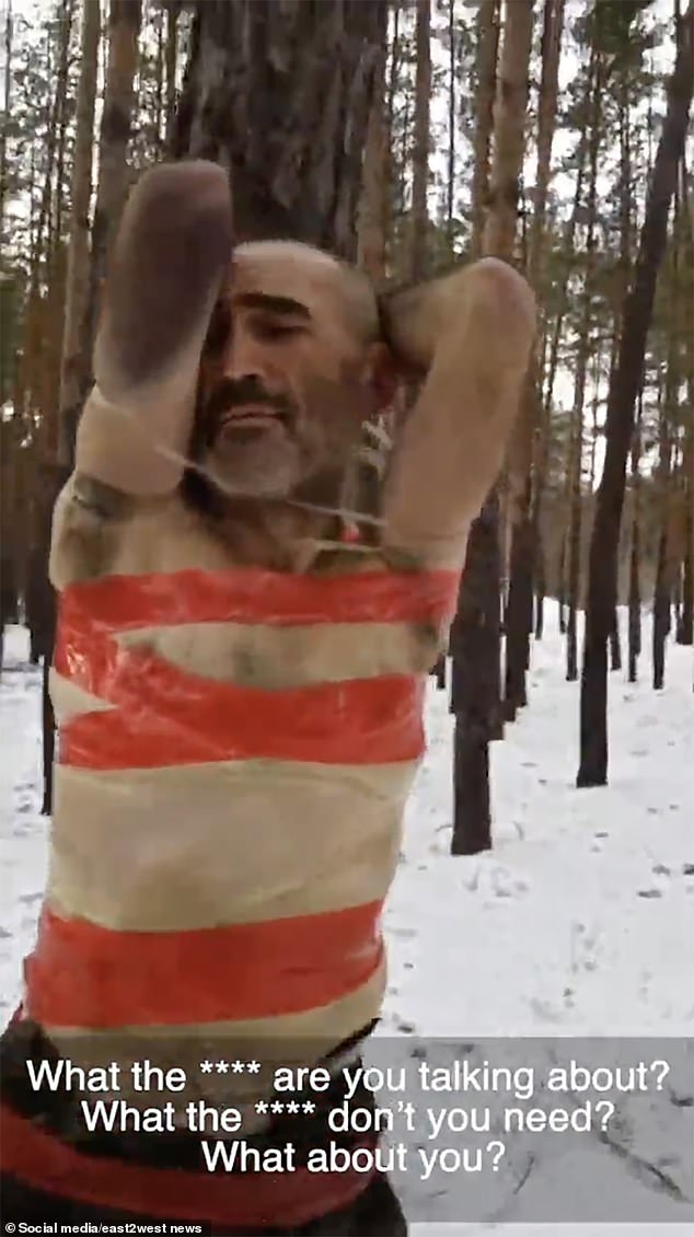 The other was seen with a massive bruise across his arm