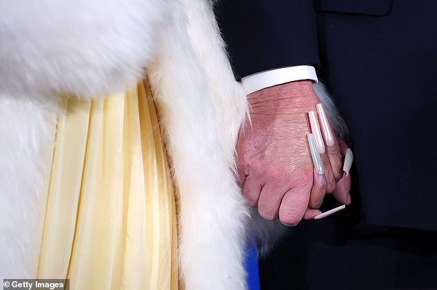 Minaj donned multi-inch-long acrylic nails with chrome colors and held the hand of Trump's that is often pictured bruised and discolored from cover-up makeup due to frequent hand-shaking and his high daily dose of aspirin