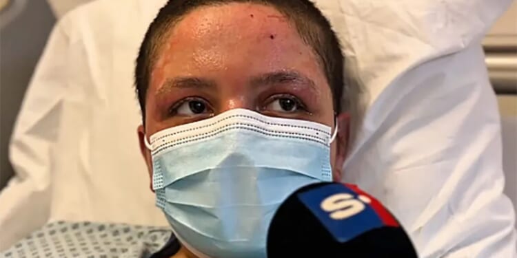 Teen survivor, 18, of Swiss bar blaze that killed 40 wakes from coma weeks after fire & says she can't escape nightmares