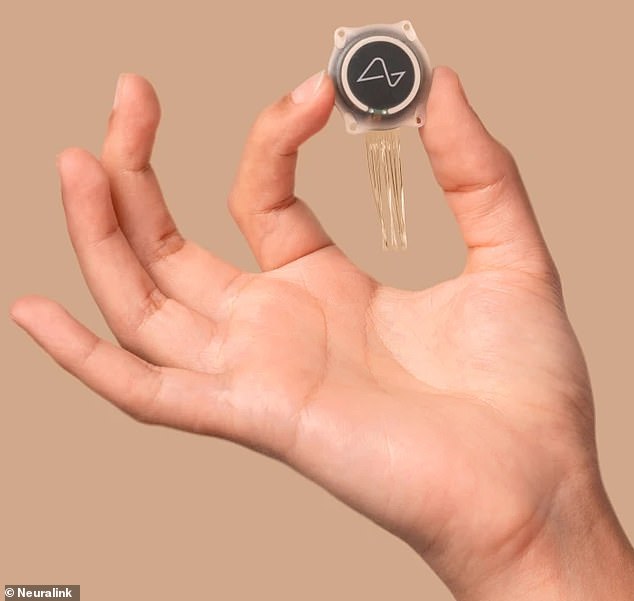 Once implanted, simply thinking about moving his hand or tapping a finger can move a cursor or register a mouse click on a screen