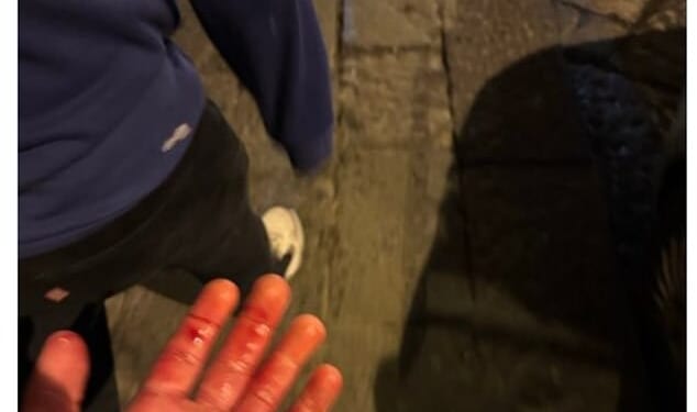 One Chelsea fan posted this image of his blood-soaked hand and said he'd been stabbed