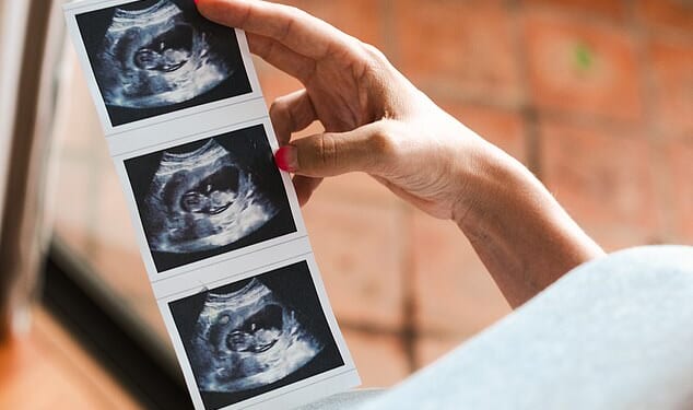 Fury as NHS tells midwives to back cousin marriage as 'only' 15 per cent have deformed babies