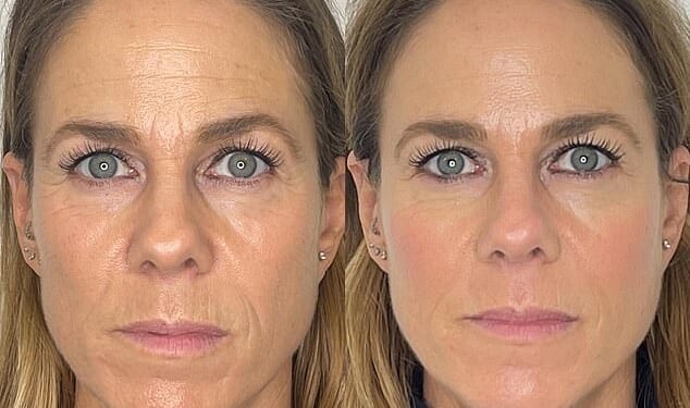 Laura Gee's before and after pictures. 'One morning I looked in the mirror and thought, "Oh hello, that is the face I have missed",' she writes