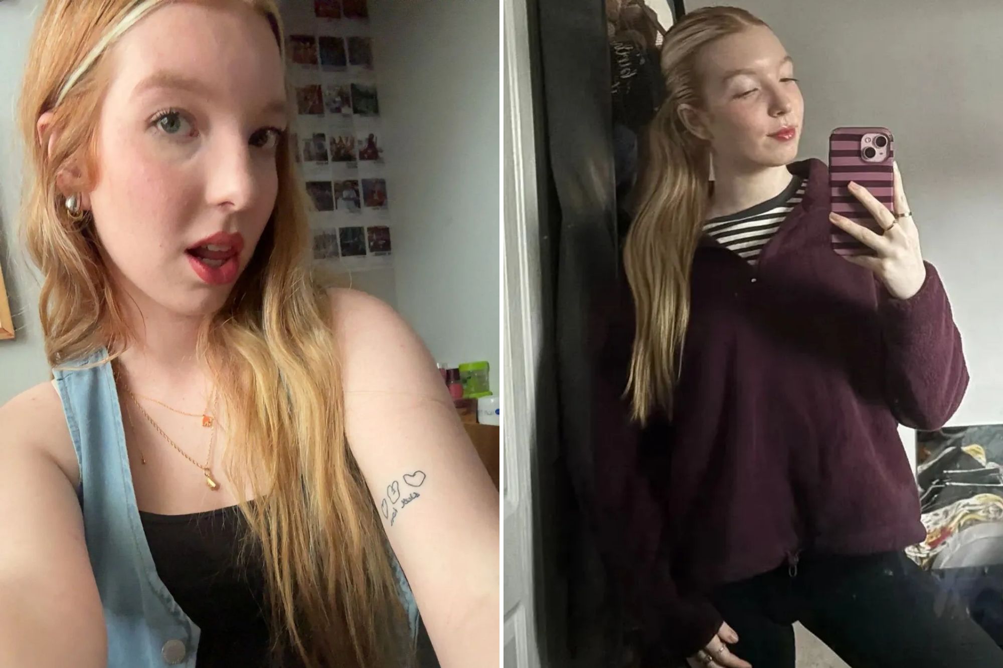 An image collage containing 2 images, Image 1 shows Student born with incredibly rare disorder shares condition with dogs, Image 2 shows Student born with incredibly rare disorder shares condition with dogs