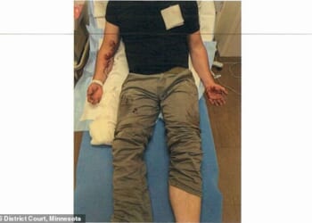The officer needed 20 stitches in his right arm after being dragged 100 yards in a previous incident in June