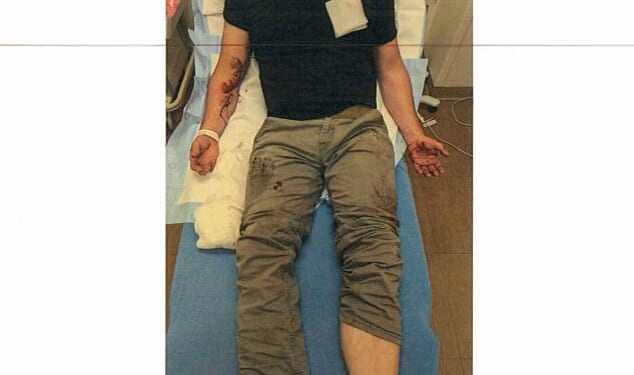 The officer needed 20 stitches in his right arm after being dragged 100 yards in a previous incident in June