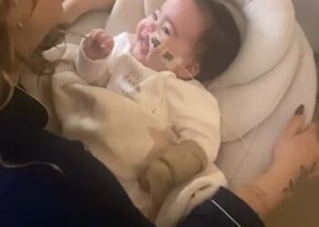 Jesy Nelson has shared a clip of one of her twin daughters with a feeding tube after revealing their muscle weakness diagnosis