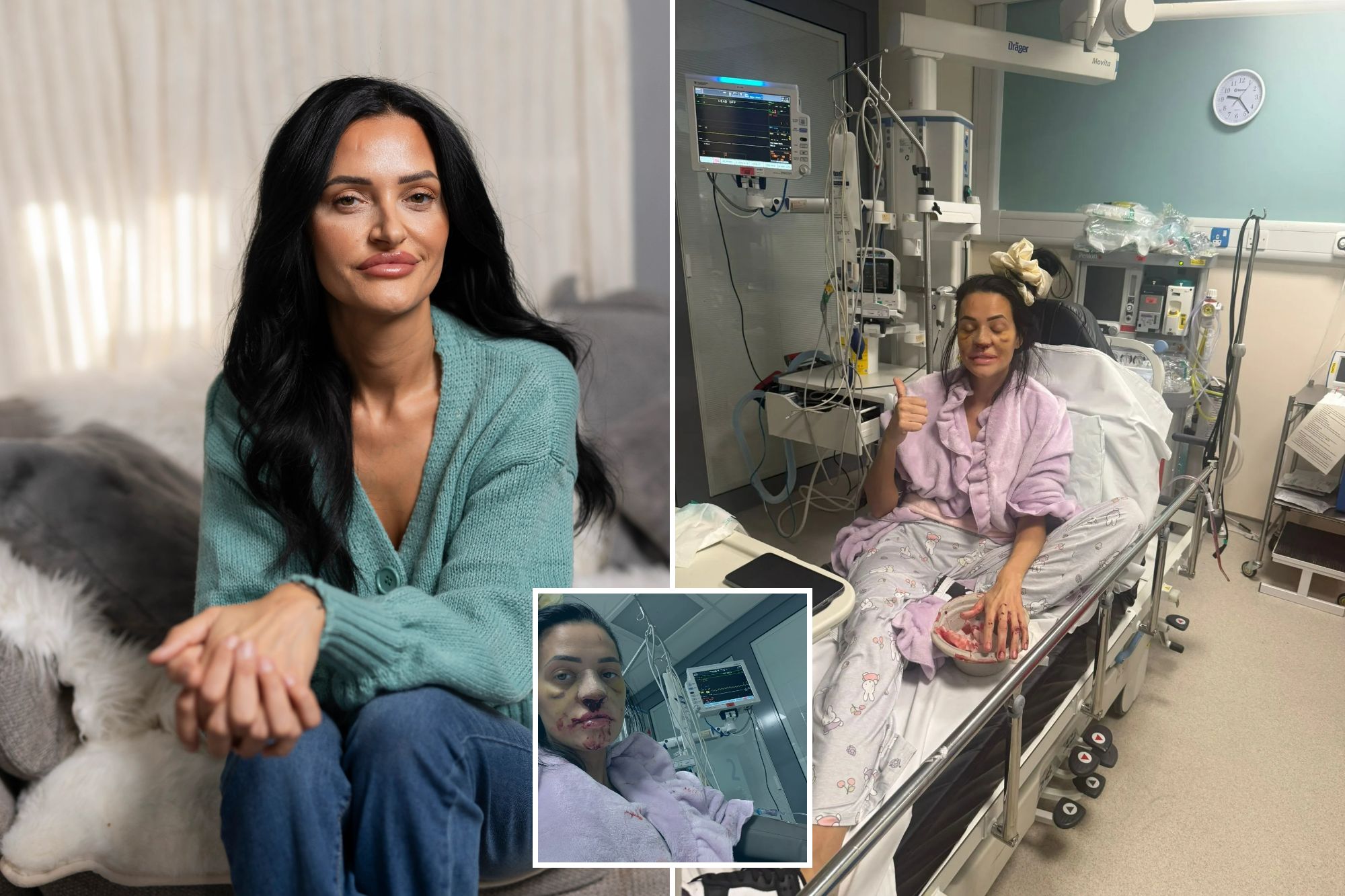 An image collage containing 3 images, Image 1 shows Whitney Ainscough, known as MeBadMom, sitting on a sofa at home, Image 2 shows Whitney Ainscough recovering in a hospital bed with a thumbs up after a nosebleed, Image 3 shows Whitney Ainscough in a hospital bed with blood on her face, nose, and robe