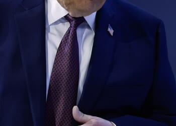 President Donald Trump has revealed how he got a bruise on his left hand