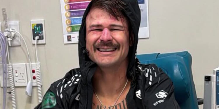 UFC star Diego Lopes in brutal picture from hospital after breaking BOTH FEET in loss to Alexander Volkanovski