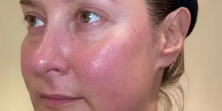 I hated my rosy pink skin so tried a £5 serum for a fortnight to see if it helped