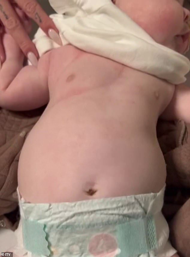 Former Little Mix singer Jesy has demanded the NHS expand the standard heel prick to check for spinal muscular atrophy. Tests cost around £1 each and doctors 'could have saved their legs' with early treatment