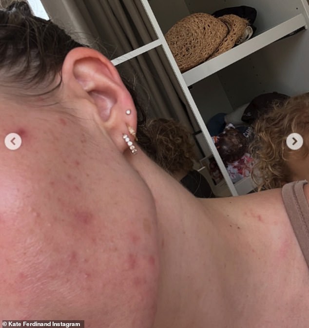 Since the start of the year, Kate has opened up to her followers about how she's struggled with 'fatigue' and feeling 'pressured to do everything'