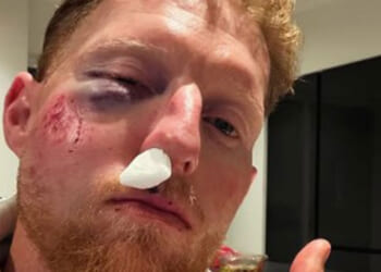 'You should see the cricket ball'