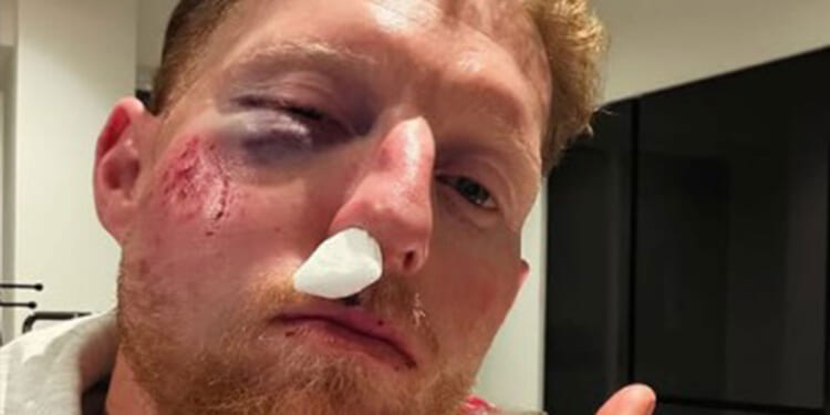 'You should see the cricket ball'