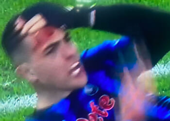 Atalanta star left with blood all over face after taking boot to head in controversial foul that sees THREE sent off