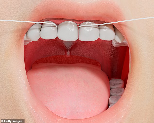 We can sort it out ourselves for free if we brush properly – it’s about elbow grease