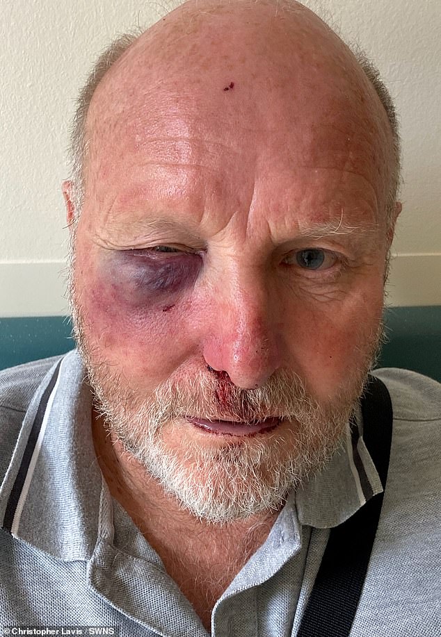 The grandfather said he was 'very disappointed' his attacker wasn't handed a custodial sentence after pleading guilty to assault causing actual bodily harm