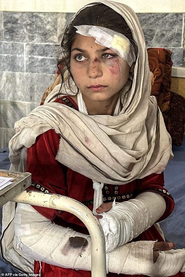 An injured Pakistani girl being treated for her wounds at a hospital in Bajaur, Pakistan following overnight cross-border fighting between Pakistan and Afghanistan