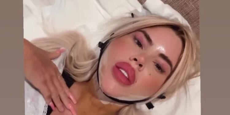 Hannah Elizabeth shares snap from hospital bed as she's bandaged up after £100k 'Bratz Doll' surgery