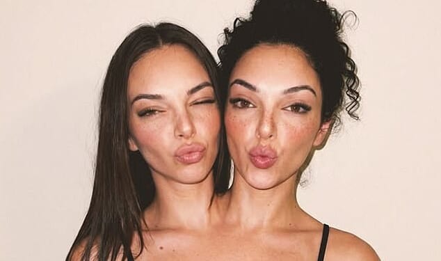 Conjoined twin 'influencers' who have taken social media by storm have been revealed to be AI¿generated