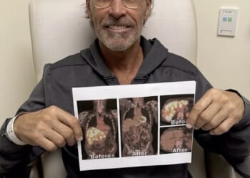 Former New York Rangers star Ron Duguay is in a battle with stage 4 cancer