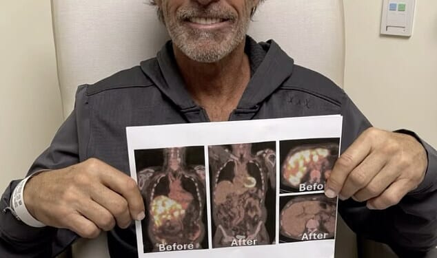 Former New York Rangers star Ron Duguay is in a battle with stage 4 cancer