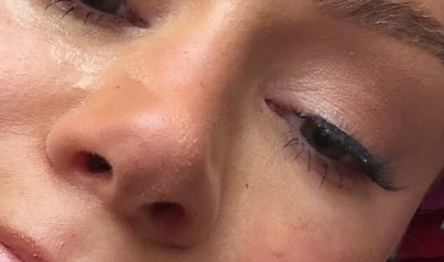 Olivia Attwood has stated she is 'p****d off at life' after breaking down in tears in the wake of her split from husband Bradley Dack