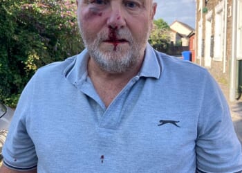 Christopher Lavis, 69, was punched in the face in the violent attack, which left him with a black eye, bleeding nose and blood-stained polo shirt